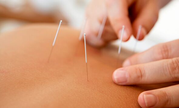 potentsialni oshirish uchun akupunktur